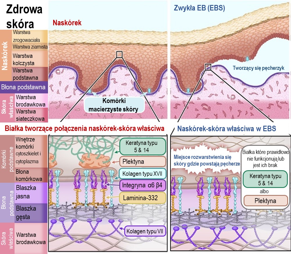 Diagram of EB Simplex