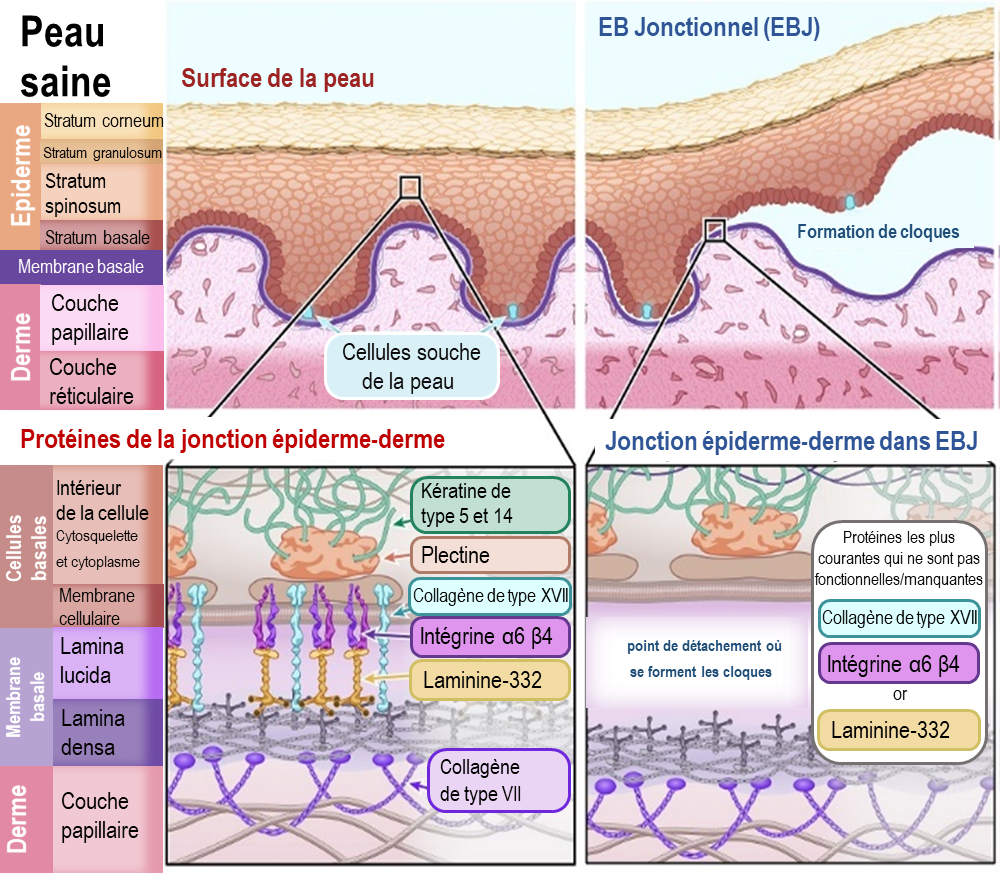 Diagram of Junctional EB