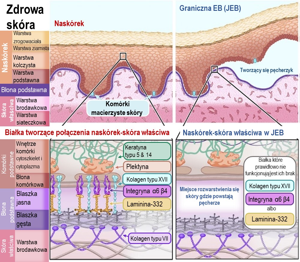 Diagram of Junctional EB