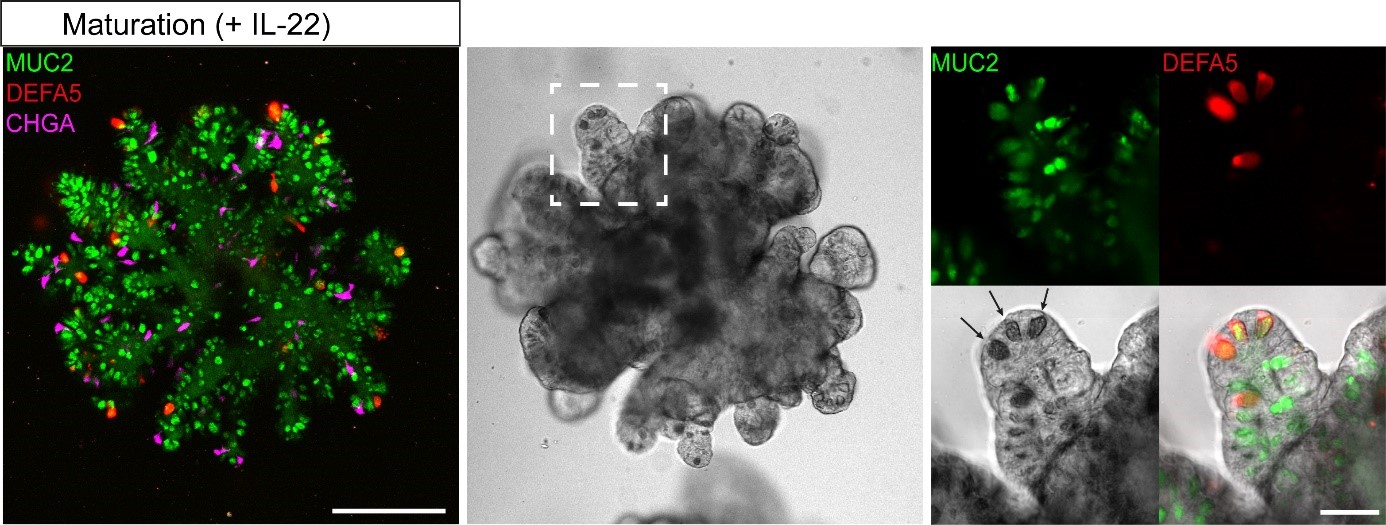 Human small intestinal organoids