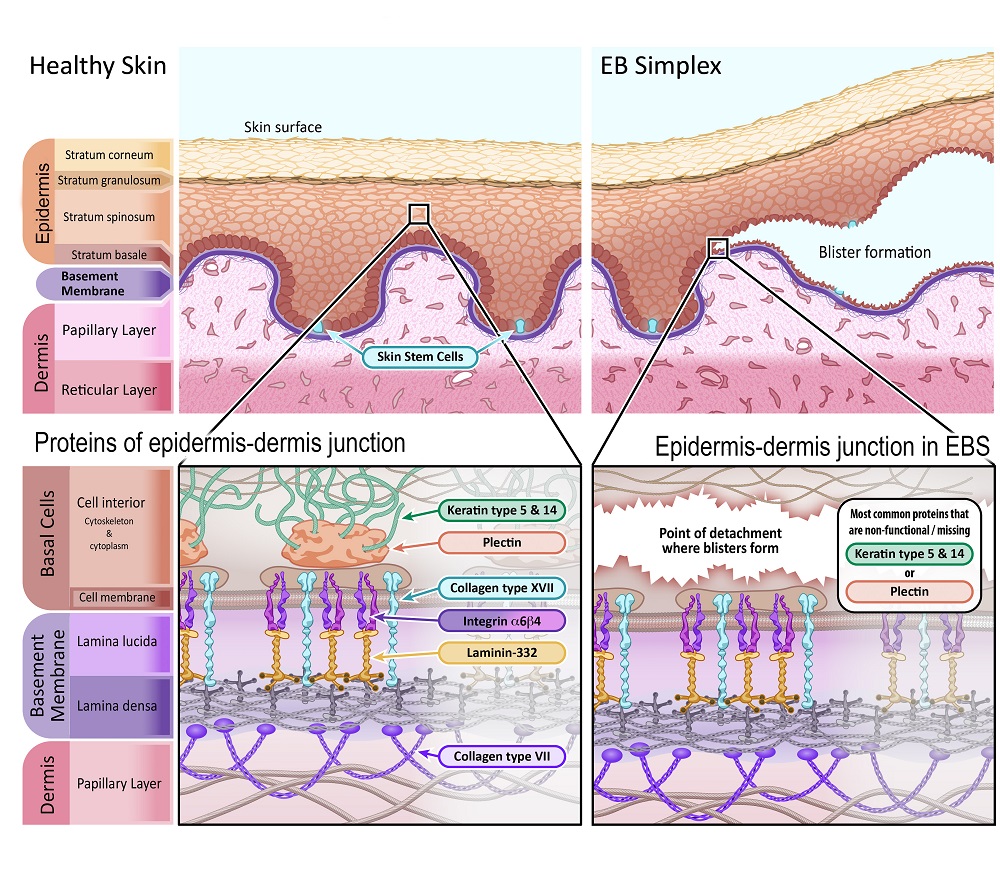 Diagram of EB Simplex