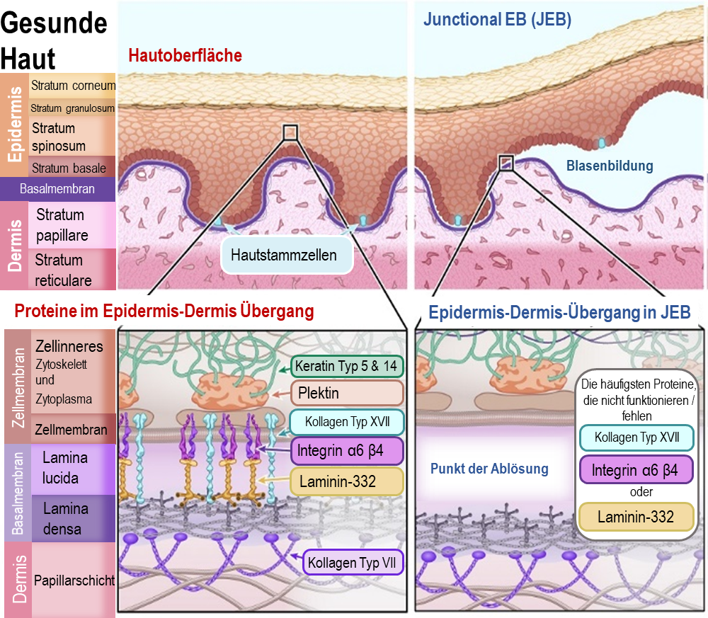 Diagram of Junctional EB