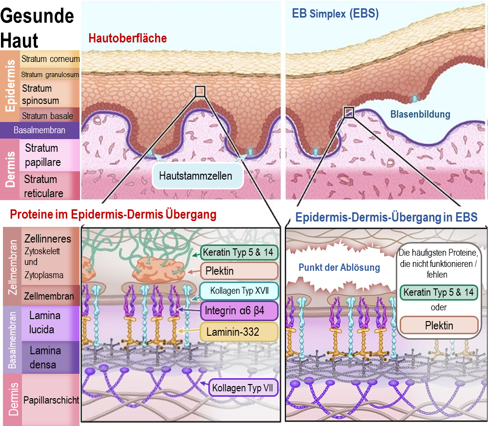 Diagram of EB Simplex