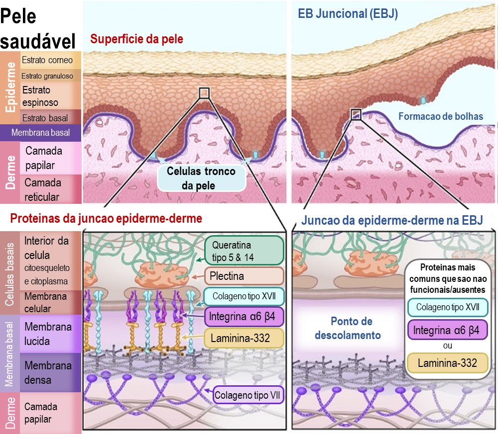 Diagram of Junctional EB