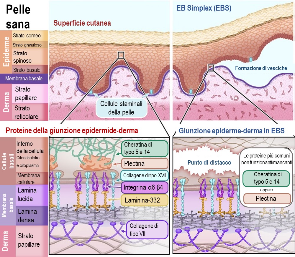 Illustrazione 2: EB Simplex