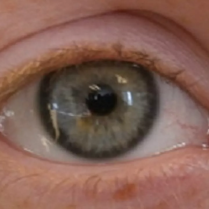 L'œil