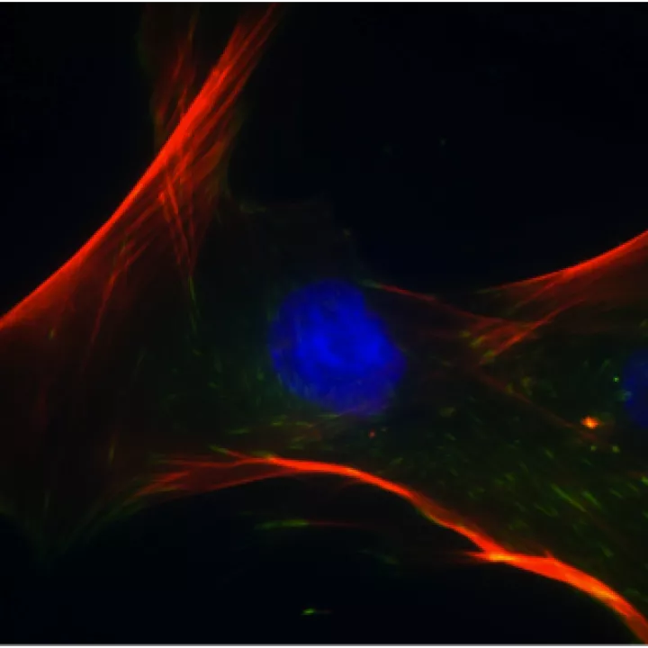 Les cellules souches mésenchymateuses