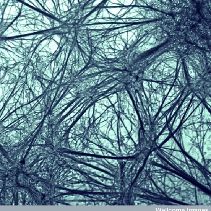 Image of neurons grown from embryonic stem cells in the lab