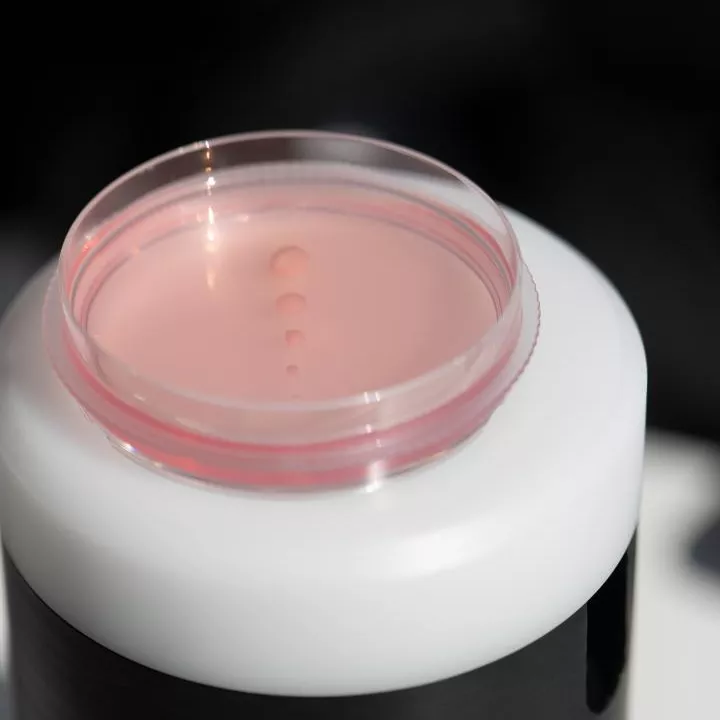 Image of cerebral organoids ina petri dish