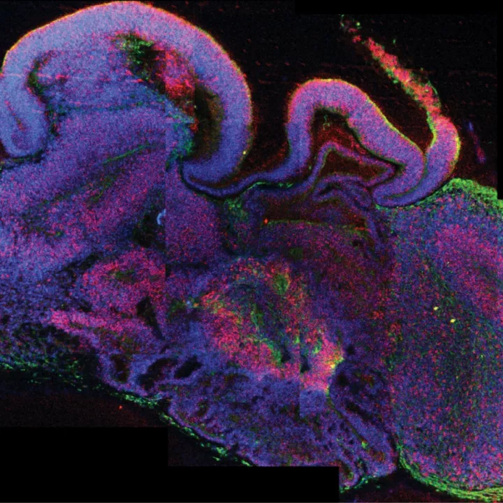 Cross-section of a cerebral organoid