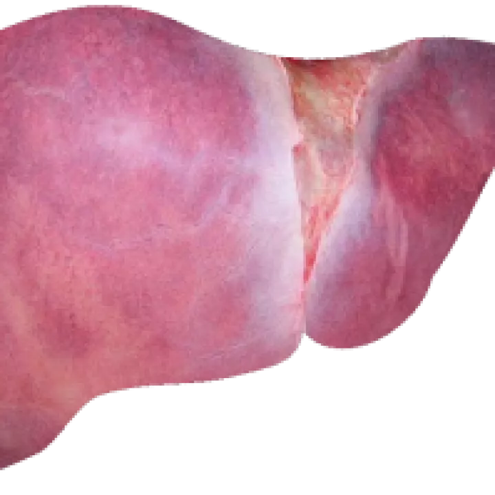 Photograph of a healthy liver