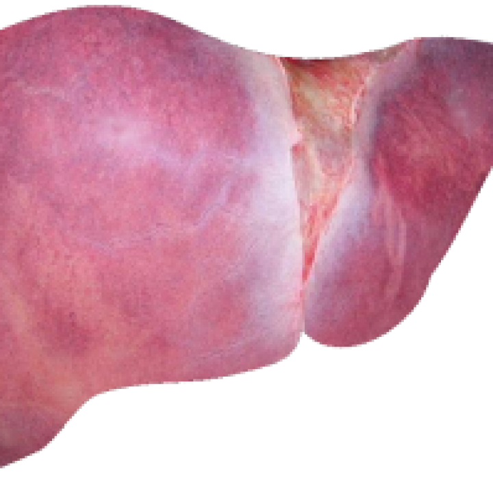 Photograph of a healthy liver