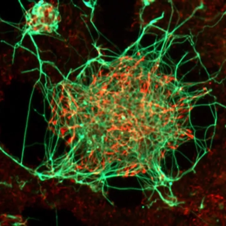 Les neurones produits à partir de cellules souches embryonnaires
