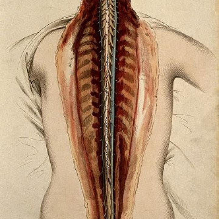 Brain and spinal cord: dissection, back view. 