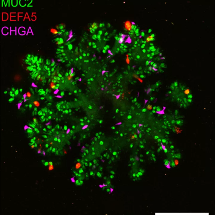 Human small intestinal organoid