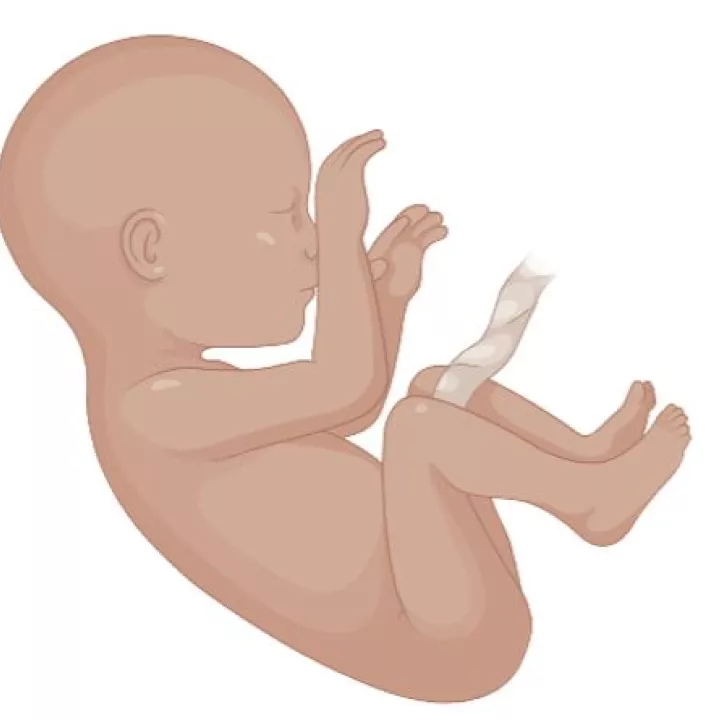 Umbilical cord teaser