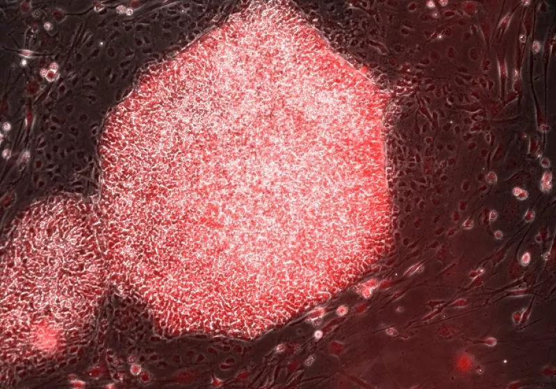 Human iPS cell colonies