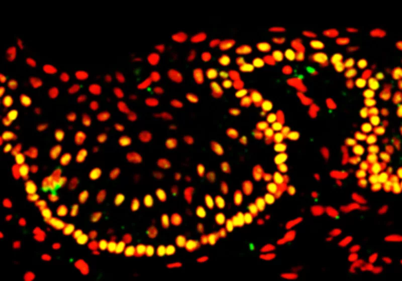 Limbal stem cells in the human cornea